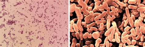 Propionibacterium Scheda Batteriologica E Approfondimenti