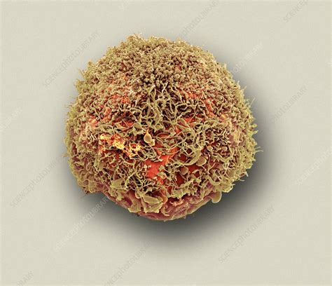 Mesenchymal Stem Cell Sem Stock Image C0153177 Science Photo