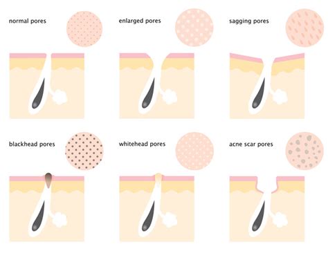 How To Minimize Pores 6 Proven Methods