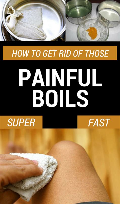 Boils Are The Result Of Hair Follicles Infection Given By A Poor