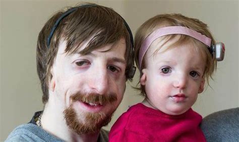 Franceschetti syndrome synonyms, franceschetti syndrome pronunciation, franceschetti syndrome translation, english dictionary definition of franceschetti syndrome. Wymondham man with Treacher Collins Syndrome has daughter ...