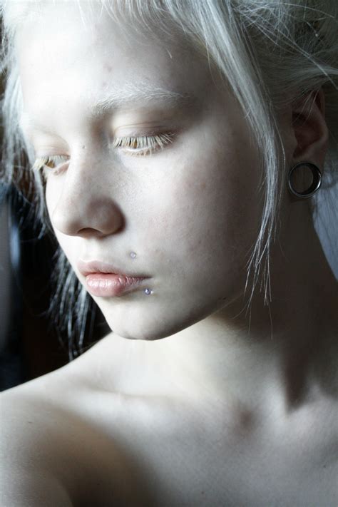 modelo albino albino model pretty people beautiful people white eyelashes acne facial