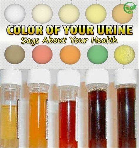 Pregnancy Urine Color Chart Warehouse Of Ideas