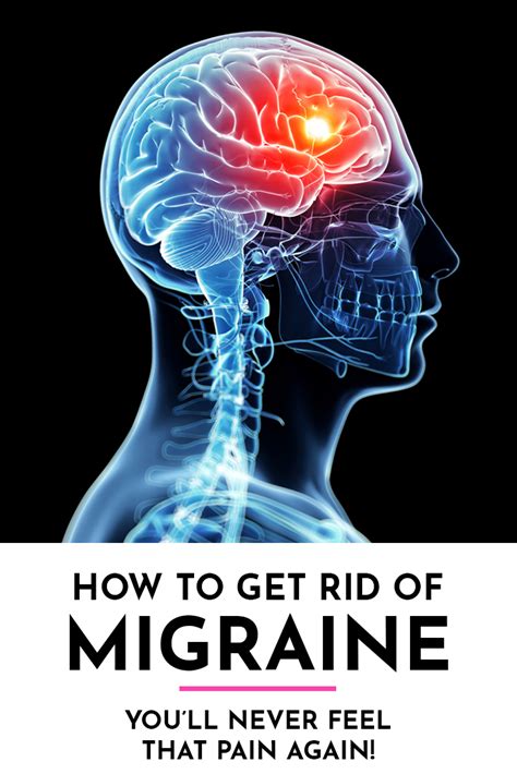 How To Permanently Get Rid Of Migraine 100 Natural Organic Solutions Based On Ancient Wisdo