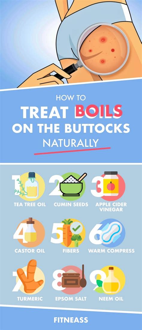 How To Treat Boils On The Buttocks With Natural Remedies ...