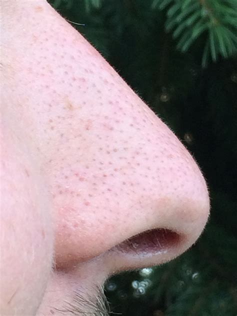 American heritage® dictionary of the english language, fifth edition. Human nose - Wikipedia