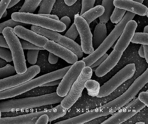 Escherichia Coli Bacteria — Science Learning Hub