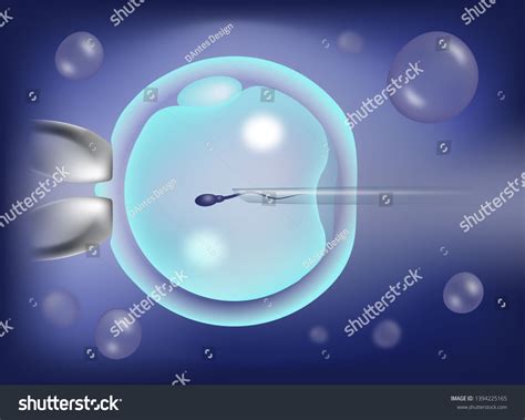 Inyecci N De Esperma Intracytoplasm Tico Icsi Como Ilustraci N De