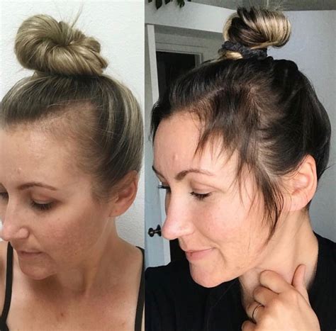 Pin On Monat Before After