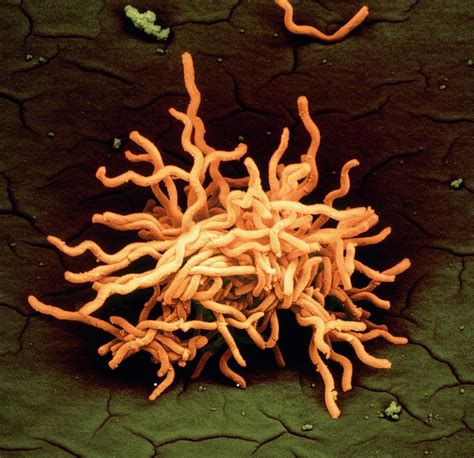 Borrelia is a genus of bacteria of the spirochete phylum. Borrelia Burgdorferi Bacteria Photograph by Juergen Berger ...