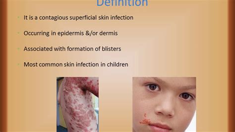 Common Skin Disorders In Children Vo Youtube