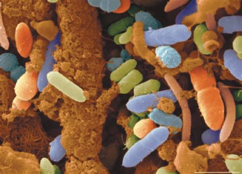 A Micrograph Of Various Species Of Bacteria In Human Feces Bacteria Of
