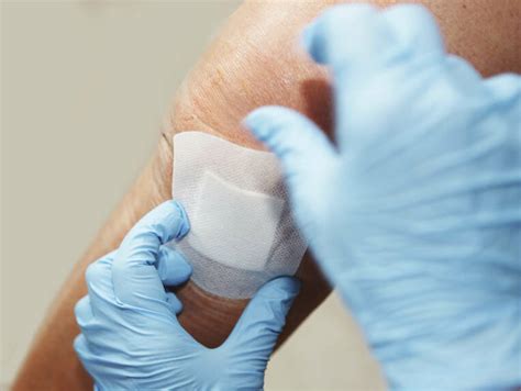 Der begriff verbandwechsel bezeichnet in der medizin und professionellen krankenpflege den wechsel einer wundauflage, um den heilungsprozess der wunde zu fördern. Welcher Verband hilft bei OP-Wunden am besten? - Online ...