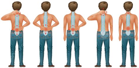 Diagrama Que Muestra Al Hombre Humano Con Dolor De Espalda Fisiología