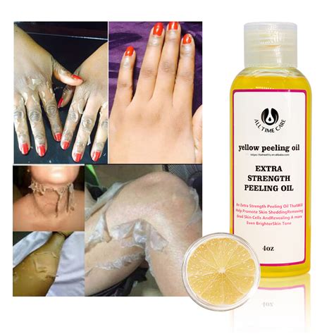 Peeling Oil Alltimecare