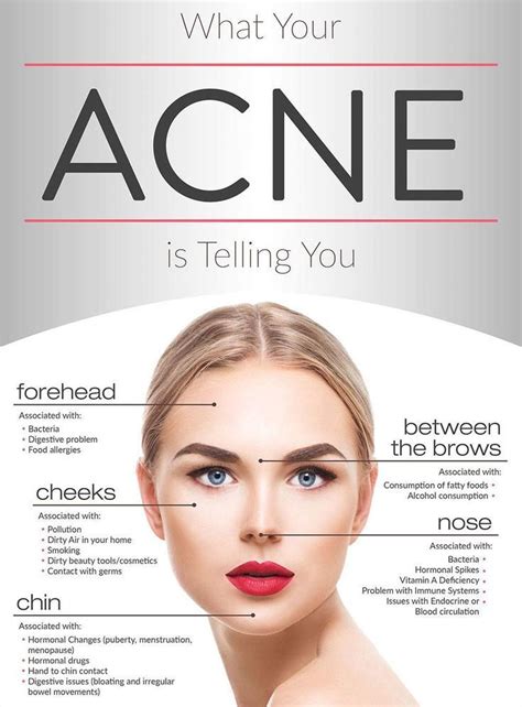 What Is Your Acne Telling You Dr Health Clinic Homepage