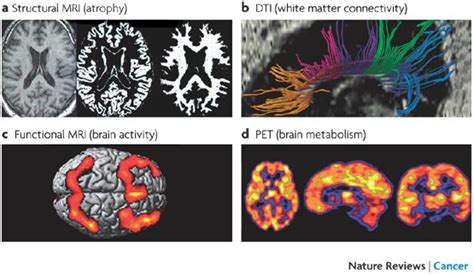 Neuroimaging Methods Relevant To The Assessment Of Cognitive Changes