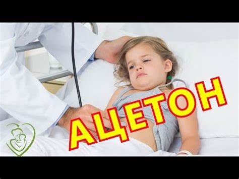 Ацетон у ребенка диета таблица