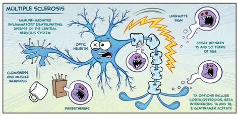 Identifying symptoms of Multiple Sclerosis might appear to be a direct