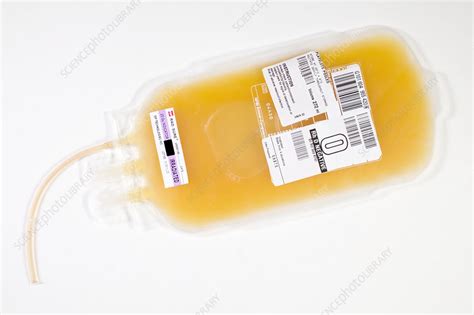 Bag Of Pooled Blood Platelets Stock Image M5320940 Science Photo