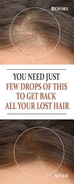 Get Back All Your Lost Hair Beauty4everything3