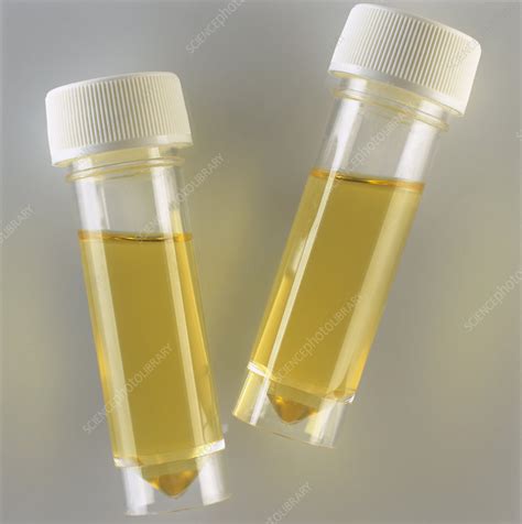 Urine Samples Stock Image M9201079 Science Photo Library