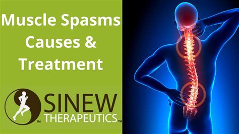 Muscle Spasms Causes And Treatment Youtube