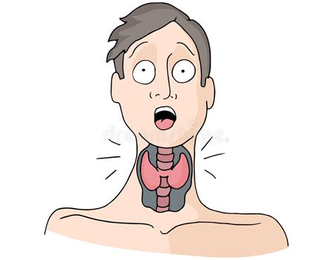Thyroid Medical Condition Man Stock Vector Illustration Of Vector