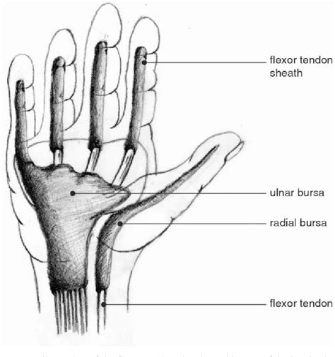 Start studying sports medicine terminology. Trigger Finger, Trigger Finger Treatment in Kenya,knee ...