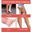 Ankle Edema / Swelling  Causes FAQs