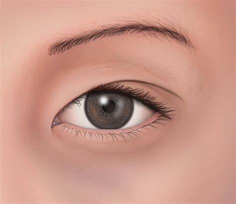 asian eye color american academy  ophthalmology