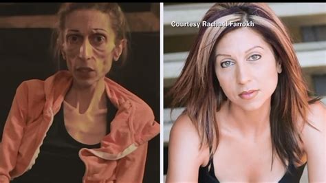 Internet Reaches Out To Save Anorexic Woman S Life Abc Houston