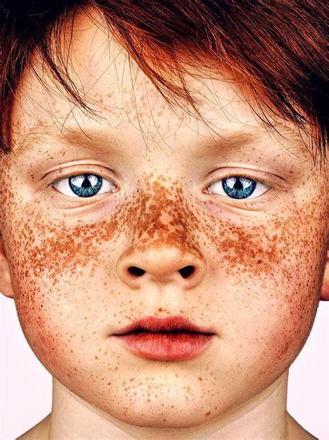 Photographer Takes Stunning Portraits Of People With Freckles And