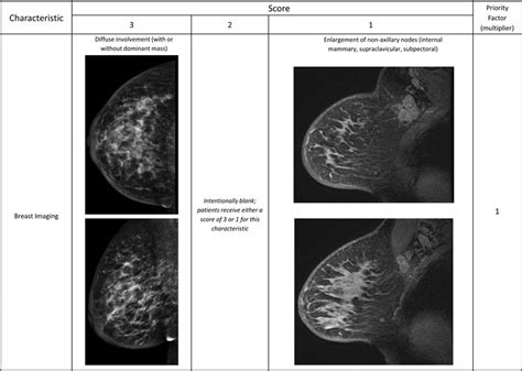 imaging characteristics of inflammatory breast cancer variations of download scientific
