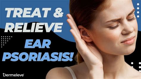 Ear Psoriasis Natural Treatment Say Goodbye To Pain And Itching Youtube