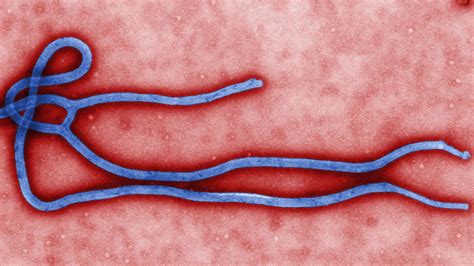 First Case Of Ebola Diagnosed In The Us Cdc Reports The Verge