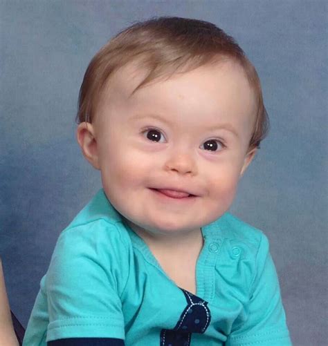 Baby Jude On His Birthday ♥ Down Syndrome Awareness Precious Children
