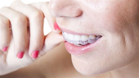 How To Clean Invisalign At Home Clean Invisalignclean Invisalign