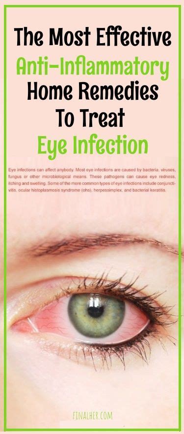 25 Effective Home Remedies To Treat Eye Infection Eye Infections