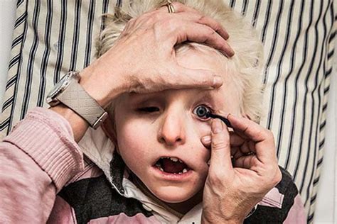 This Photographer Captured This Touching Moment Of A Boy Born Without Eyes