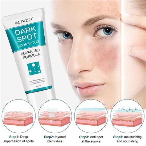 Buy Elaimei Freckle Remover Cream Dark Spot Remover Corrector Age