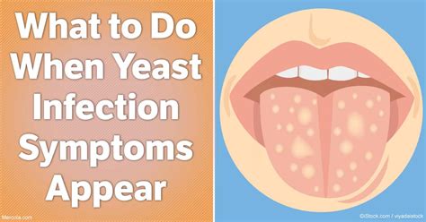 What To Do When Yeast Infection Symptoms Appear