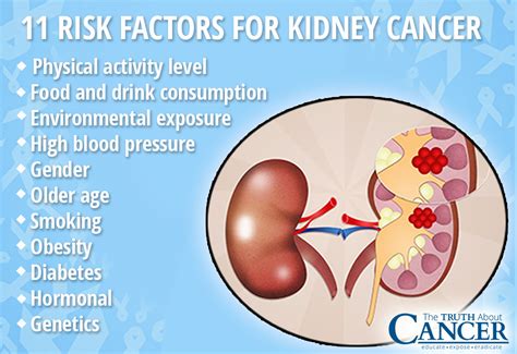 Kidney Cancer Causes Factors Putting You At Risk