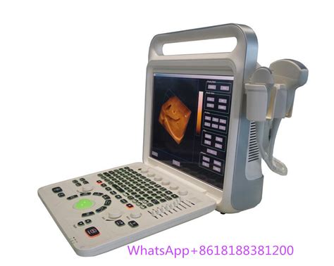 Portable Echocardiography Machine 2d Echo Echographe Cardiac 3d 4d