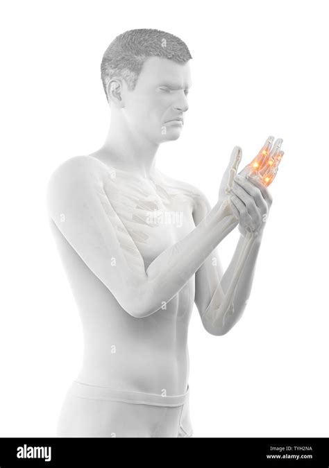 3D prestados ilustración médica exacta de dolor en las articulaciones