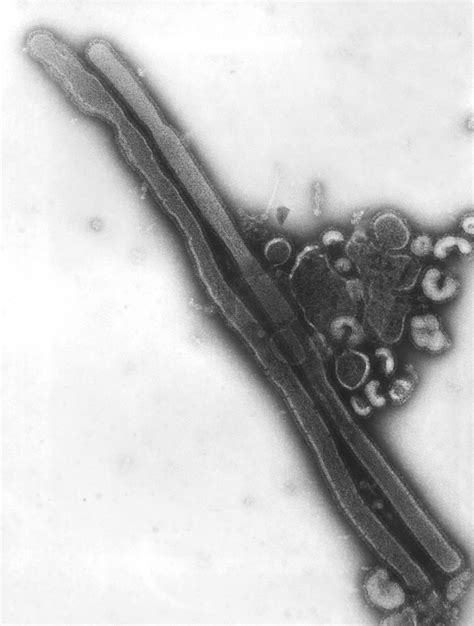 Imagem Gratuita Transmissão Micrografia Eletrônica Presença Gripe