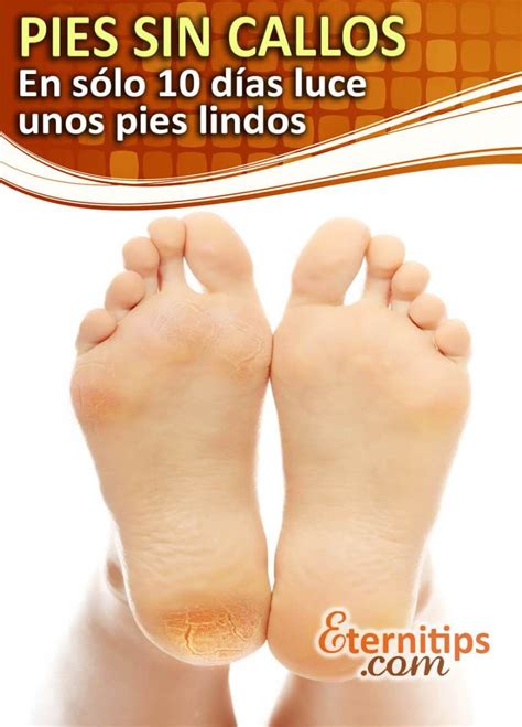 Eliminar Los Callos De Los Pies De Una Forma Efectiva Feet Treatment