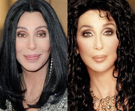 Cher Before And After Plastic Surgery Life To Star Celebrity Plastic Surgery Plastic