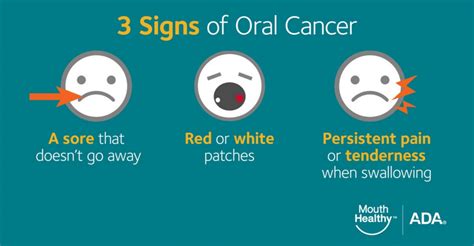 Oral Cancer Screening Scarborough Dentist And Implant Clinic Newby