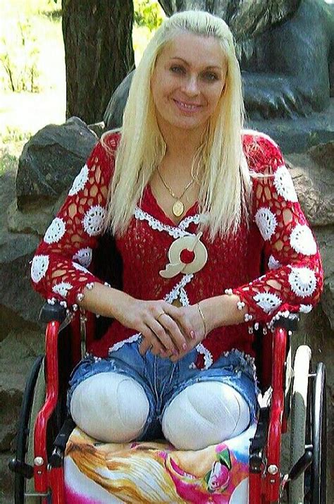 Oksana With Recent DAK Amputation Of Legs Amputiert EroFound